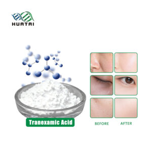 Tranexamic Acid